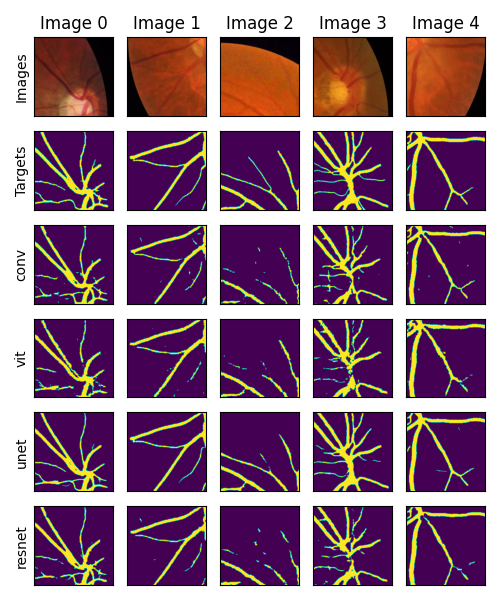 Retina Vessel Segmentation